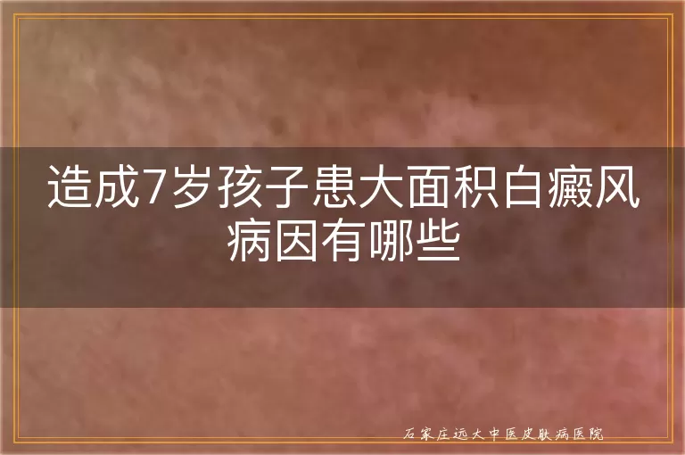 造成7岁孩子患大面积白癜风病因有哪些