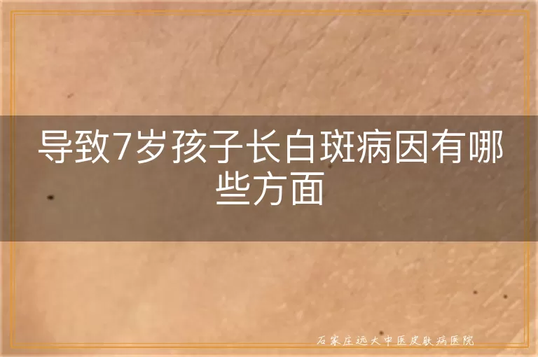 导致7岁孩子长白斑病因有哪些方面