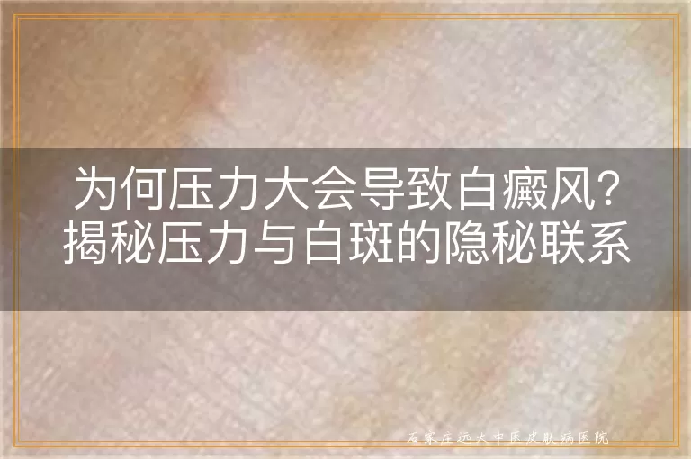 为何压力大会导致白癜风？揭秘压力与白斑的隐秘联系