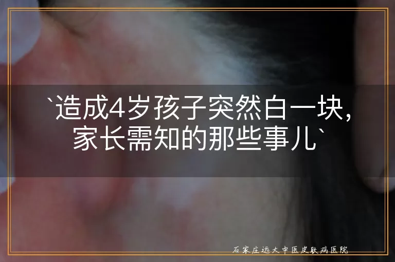 造成4岁孩子突然白一块，家长需知的那些事儿