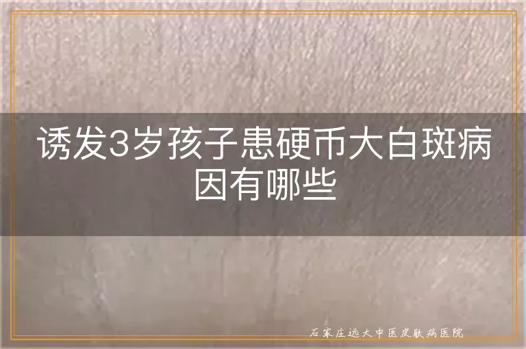 诱发3岁孩子患硬币大白斑病因有哪些