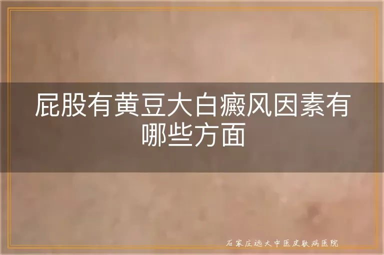 屁股有黄豆大白癜风因素有哪些方面