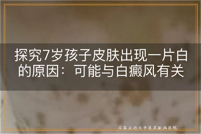 探究7岁孩子皮肤出现一片白的原因：可能与白癜风有关？