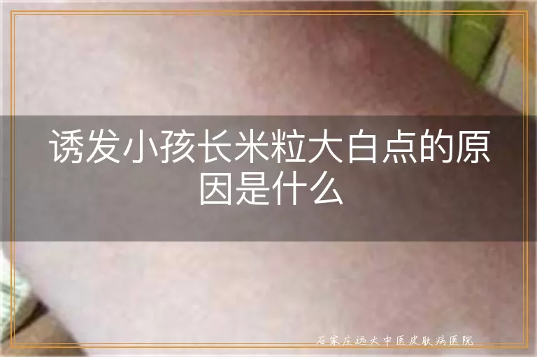 诱发小孩长米粒大白点的原因是什么
