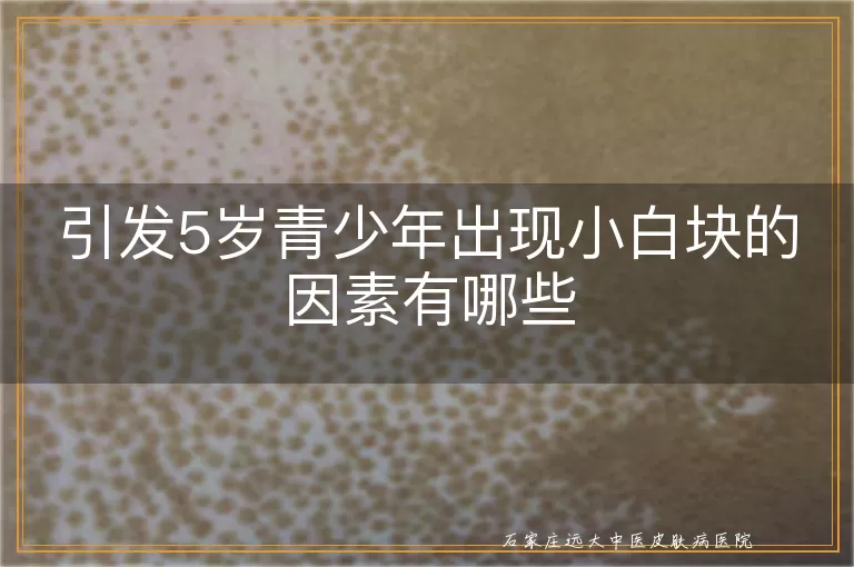 引发5岁青少年出现小白块的因素有哪些