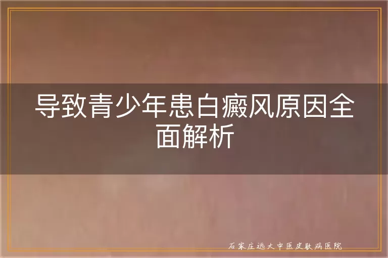导致青少年患白癜风原因全面解析