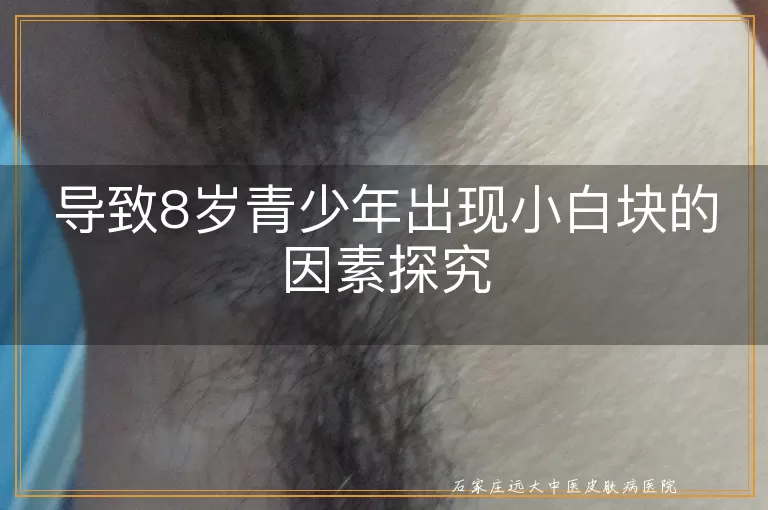 导致8岁青少年出现小白块的因素探究