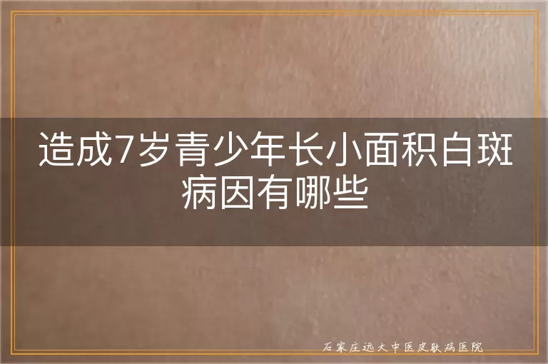 造成7岁青少年长小面积白斑病因有哪些