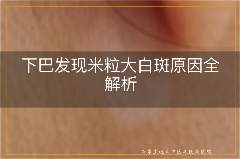 下巴发现米粒大白斑原因全解析