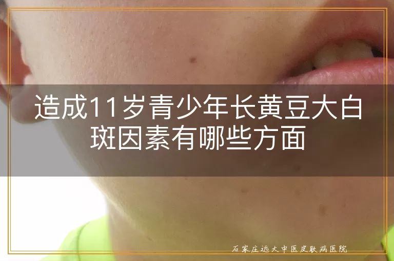 造成11岁青少年长黄豆大白斑因素有哪些方面
