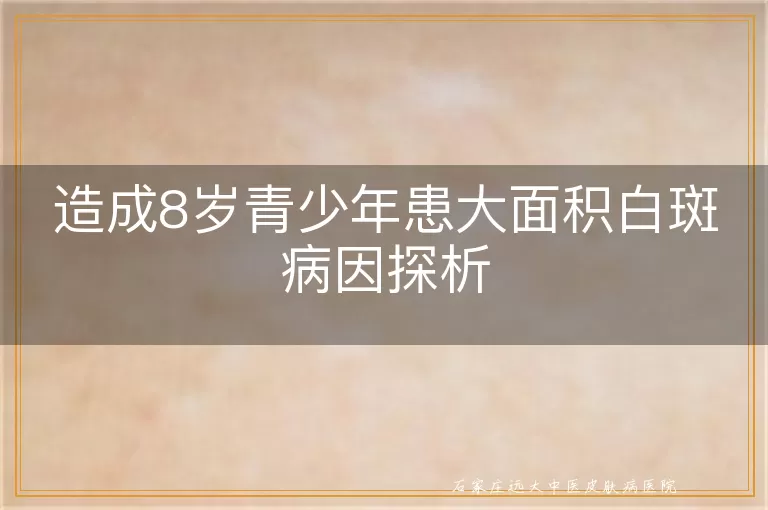 造成8岁青少年患大面积白斑病因探析