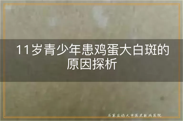11岁青少年患鸡蛋大白斑的原因探析