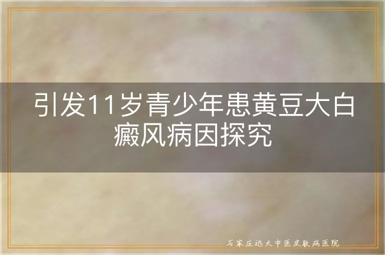 引发11岁青少年患黄豆大白癜风病因探究