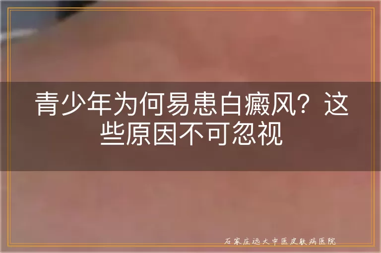 青少年为何易患白癜风？这些原因不可忽视
