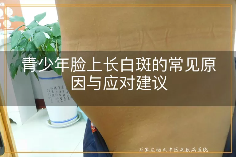 青少年脸上长白斑的常见原因与应对建议