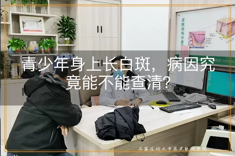 青少年身上长白斑,病因究竟能不能查清?