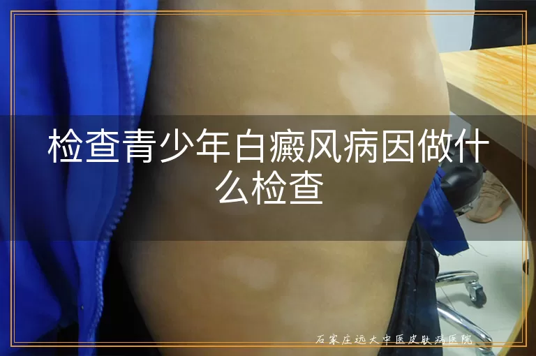 检查青少年白癜风病因做什么检查