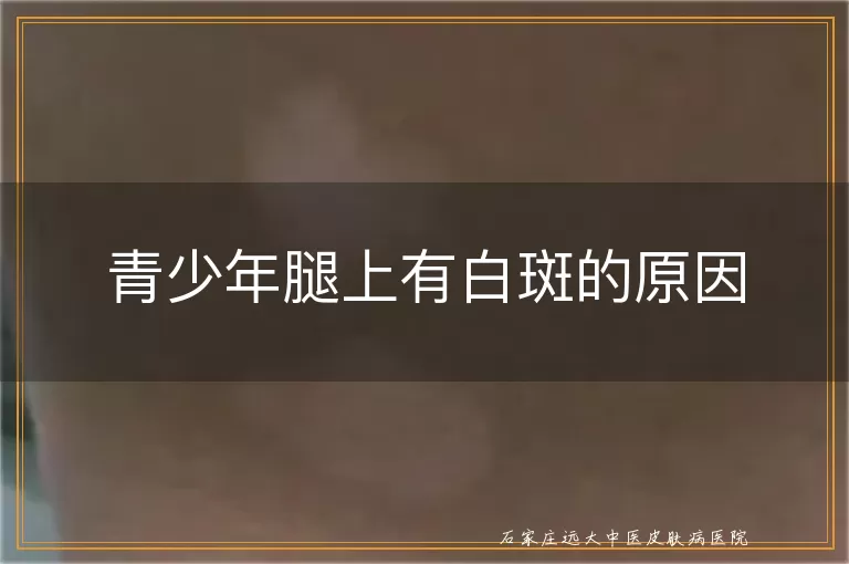 青少年腿上有白斑的原因