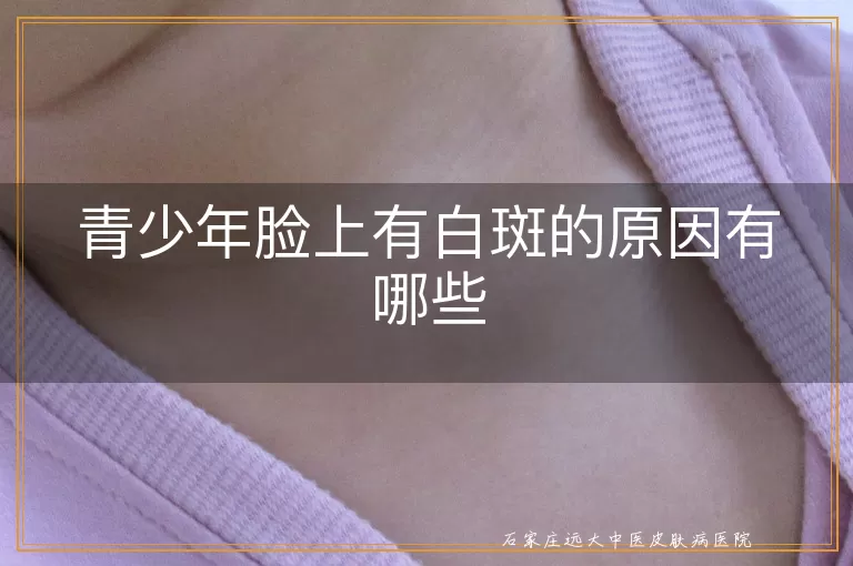 青少年脸上有白斑的原因有哪些