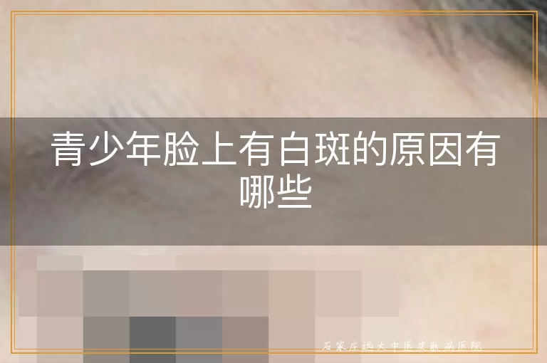 青少年脸上有白斑的原因有哪些