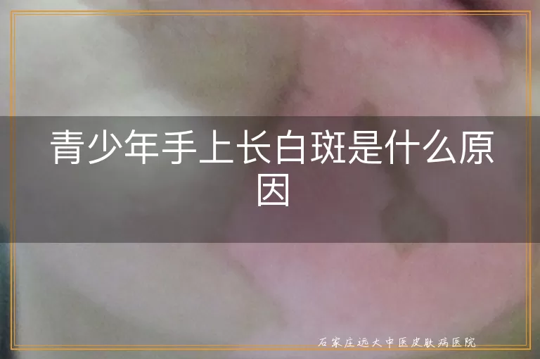 青少年手上长白斑是什么原因