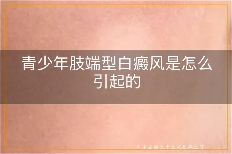 青少年肢端型白癜风是怎么引起的