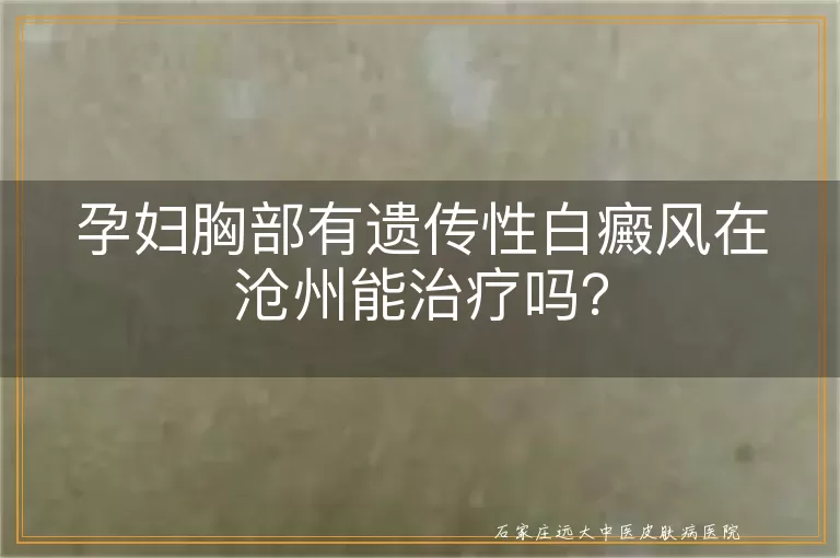 孕妇胸部有遗传性白癜风在沧州能治疗吗？