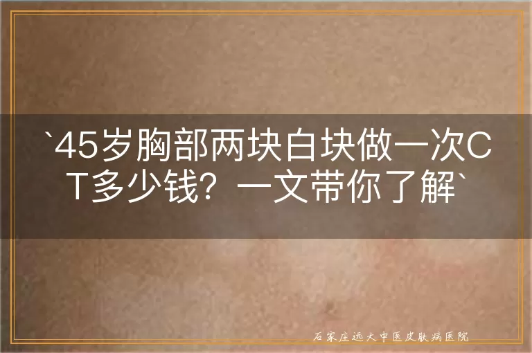 45岁胸部两块白块做一次CT多少钱？一文带你了解