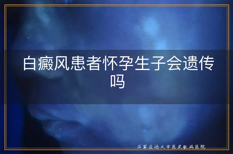 白癜风患者怀孕生子会遗传吗