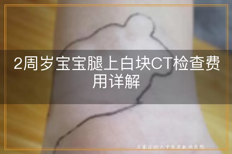2周岁宝宝腿上白块CT检查费用详解