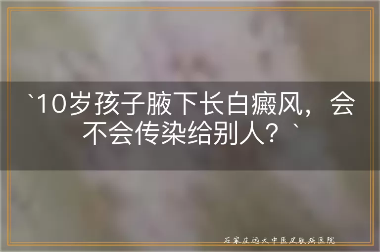 10岁孩子腋下长白癜风，会不会传染给别人？