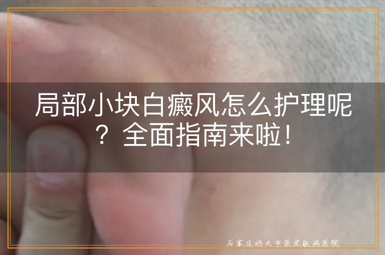 局部小块白癜风怎么护理呢？全面指南来啦！