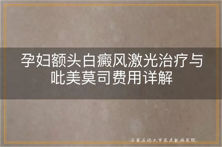 孕妇额头白癜风激光治疗与吡美莫司费用详解