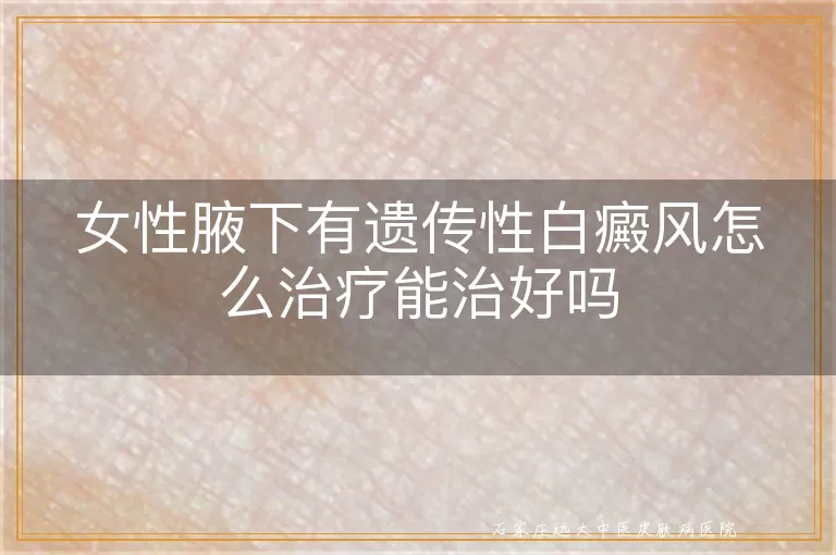 女性腋下有遗传性白癜风怎么治疗能治好吗
