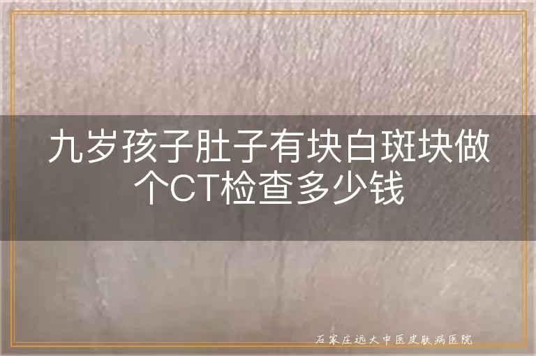 九岁孩子肚子有块白斑块做个CT检查多少钱