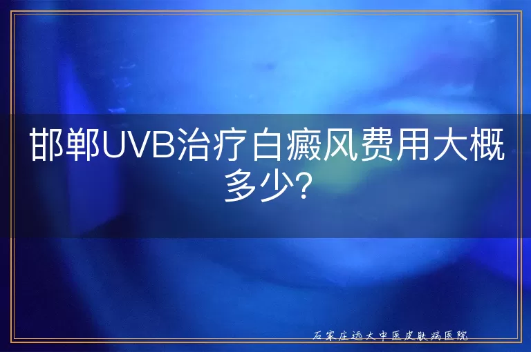 邯郸UVB治疗白癜风费用大概多少？