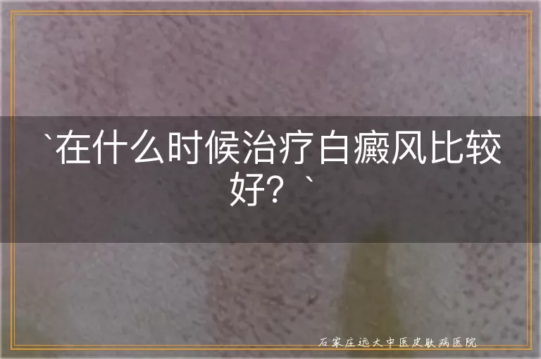 在什么时候治疗白癜风比较好？