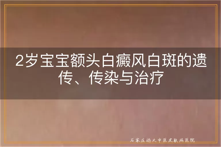 2岁宝宝额头白癜风白斑的遗传、传染与治疗