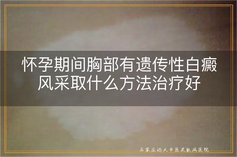 怀孕期间胸部有遗传性白癜风采取什么方法治疗好