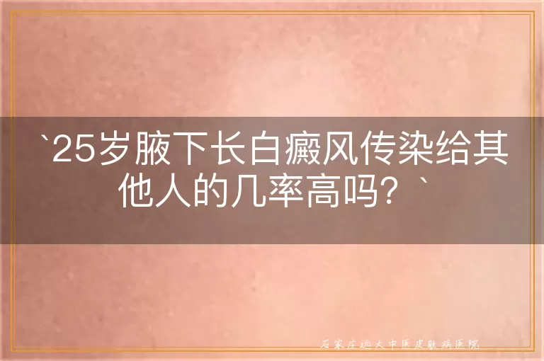 25岁腋下长白癜风传染给其他人的几率高吗？