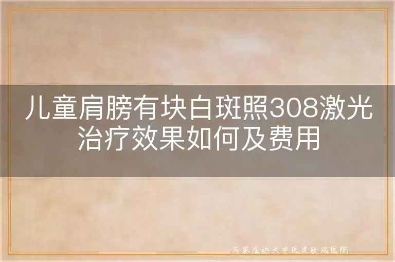 儿童肩膀有块白斑照308激光治疗效果如何及费用