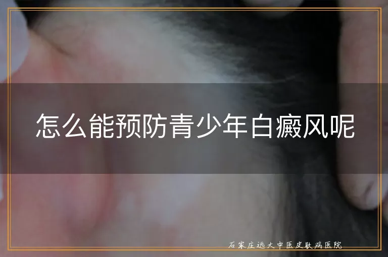 怎么能预防青少年白癜风呢