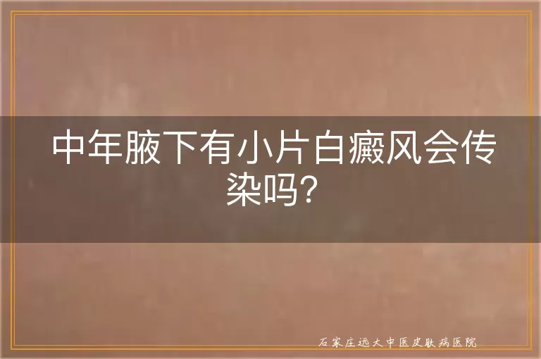 中年腋下有小片白癜风会传染吗？