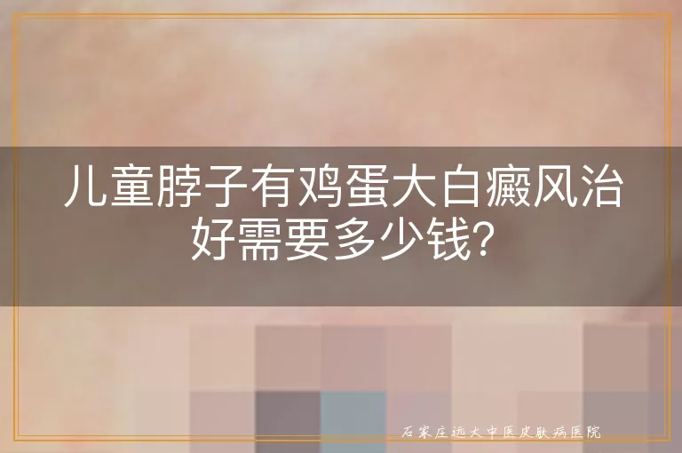 儿童脖子有鸡蛋大白癜风治好需要多少钱？