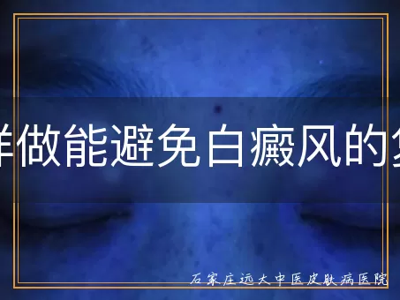 怎样做能避免白癜风的复发