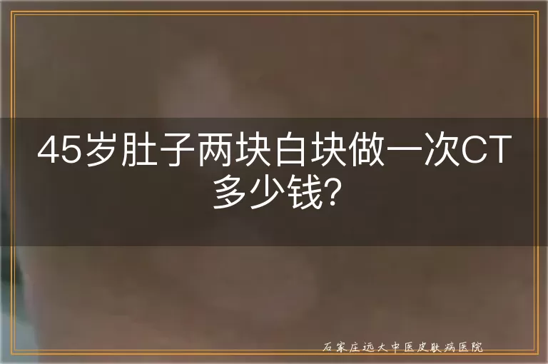 45岁肚子两块白块做一次CT多少钱？