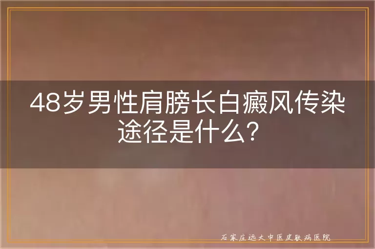 48岁男性肩膀长白癜风传染途径是什么？