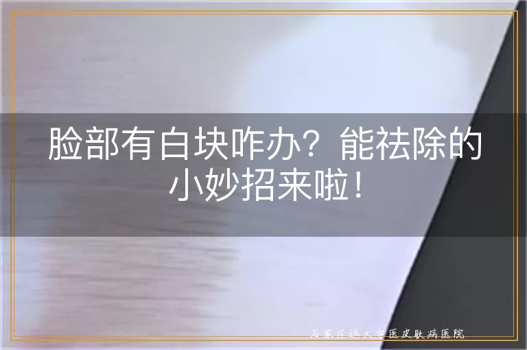 脸部有白块咋办？能祛除的小妙招来啦！