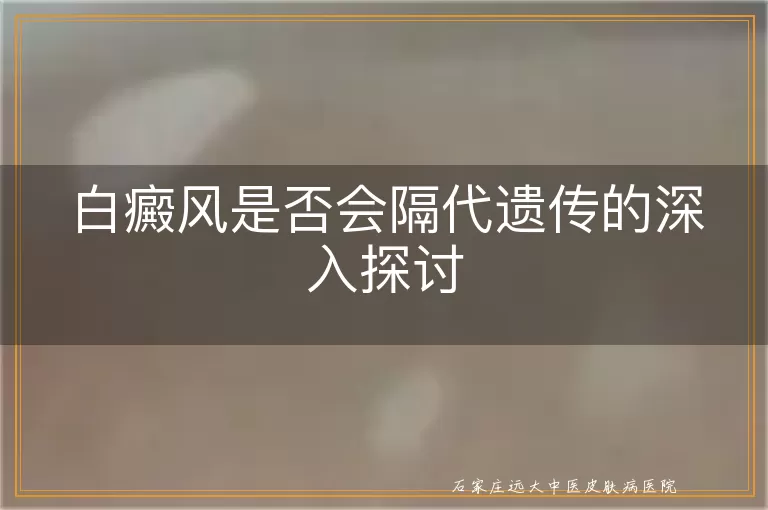 白癜风是否会隔代遗传的深入探讨