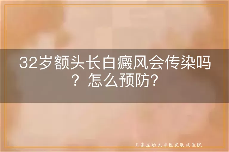 32岁额头长白癜风会传染吗？怎么预防？